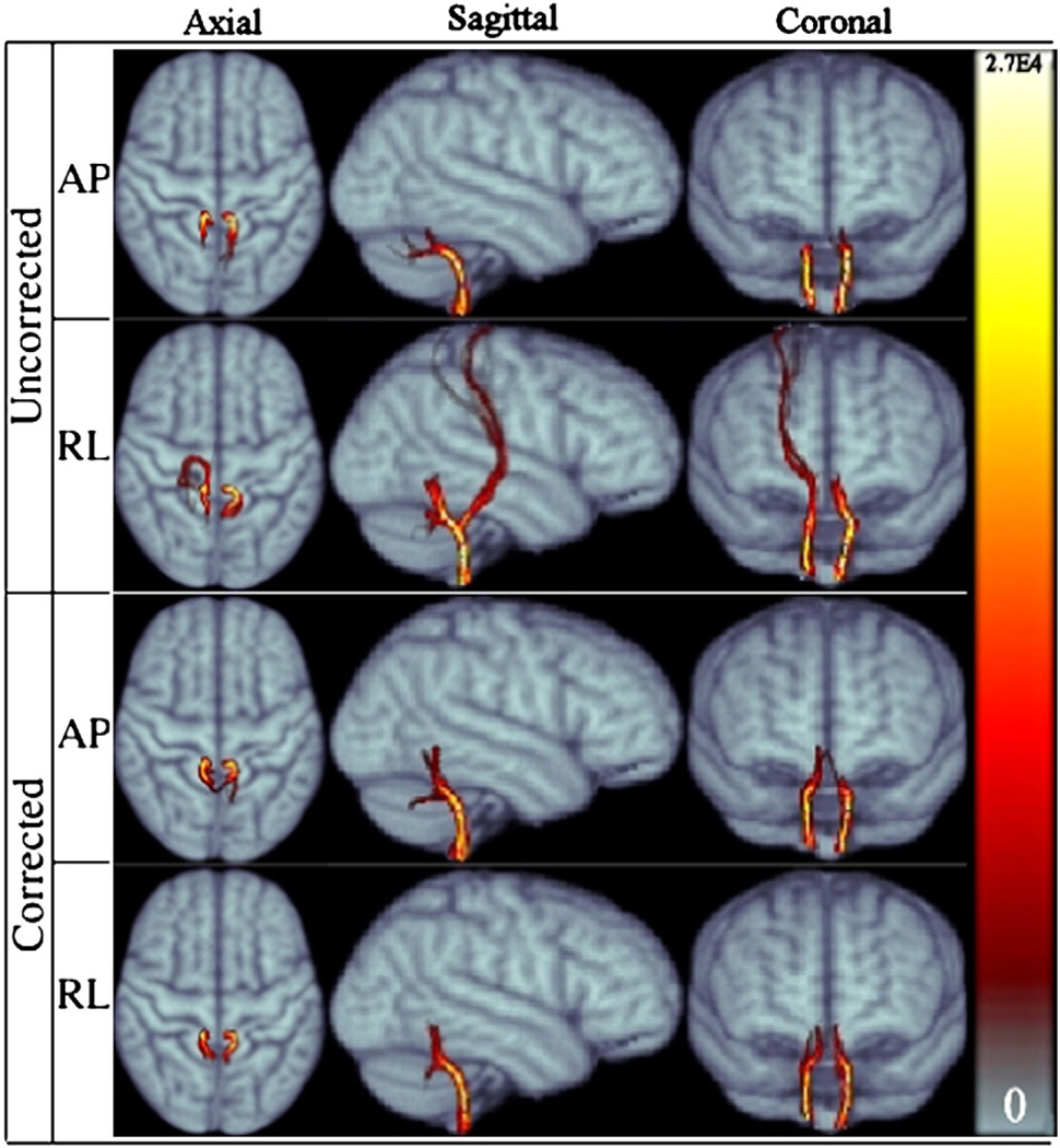 Fig. 11