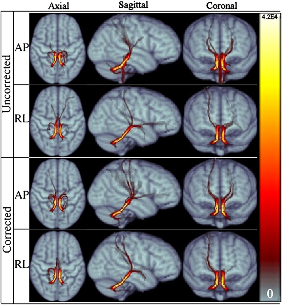 Fig. 13