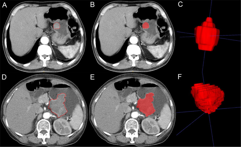 Figure 2