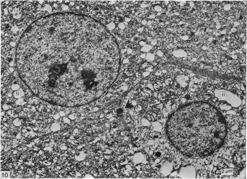 Fig. 10