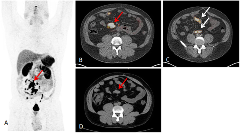 FIG. 1