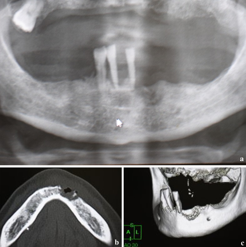 Fig. 2