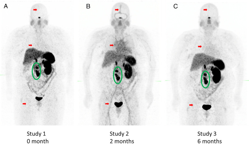 FIGURE 1