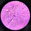 Fig. 11