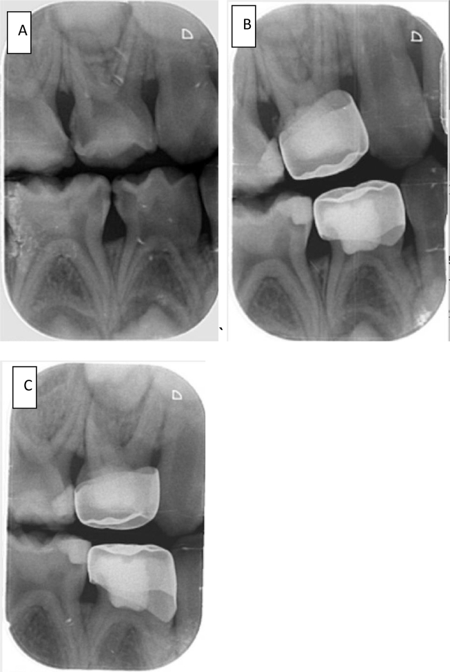 Figure 2