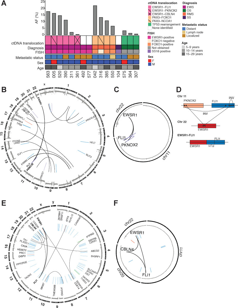 Figure 2. Translocations detected in pretreatment ctDNA. A, Oncoprint of pretreatment ctDNA translocations. Each column represents a specific patient. A bar plot at the top details the AF of a given translocation. Key clinical information is depicted below. B, Circos plot for patient 005. Copy-number changes are depicted in the outermost circle. Structural alterations are shown in the inner portion of the plot (blue, deletion; red, duplication; black, translocation; purple, inversion) and the weight of the line corresponds to the number of supporting reads. C, Circos plot focusing on rearrangements that form a loop for same sample as in (B). D, Schematic showing EWSR1-FLI1 fusion generated from complex loop rearrangement. E, Circos plot for patient 361. F, Circos plot focusing on looped rearrangements for same sample as in (E). INV, Inversion.