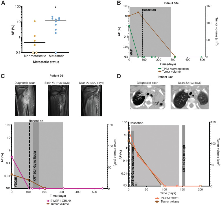 Figure 3. ctDNA levels correlate with clinical features. A, Metastatic patients (n = 10) had higher levels of pretreatment ctDNA compared with nonmetastatic patients (n = 6). P value = 0.0224 (calculated by the Mann–Whitney U test). Serial ctDNA levels detected by CAPP-seq reflect response to therapy in osteosarcoma (B), Ewing sarcoma (C), and alveolar rhabdomyosarcoma (D). ND, not detected; M, methotrexate; A, adriamycin; P, cisplatinum; V, vincristine; D, doxorubicin; C, cyclophosphamide; I, ifosfamide; E, etoposide; XRT, radiotherapy.