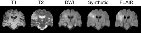 Fig. 11