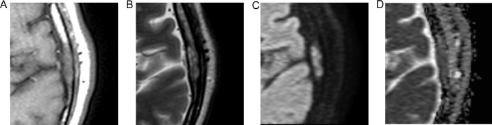 Fig. 2 –