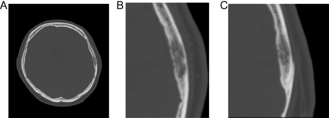 Fig. 1 –