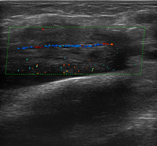 Fig. 10