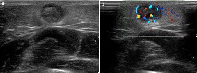 Fig. 15