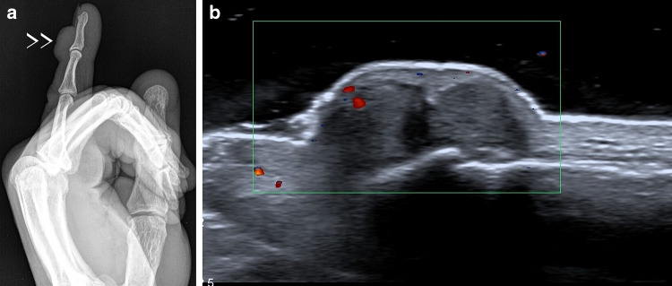 Fig. 14