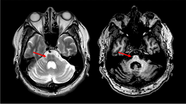 Fig. 5