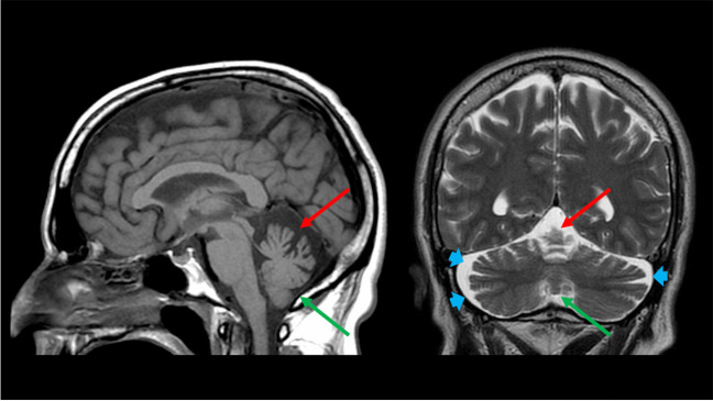 Fig. 2