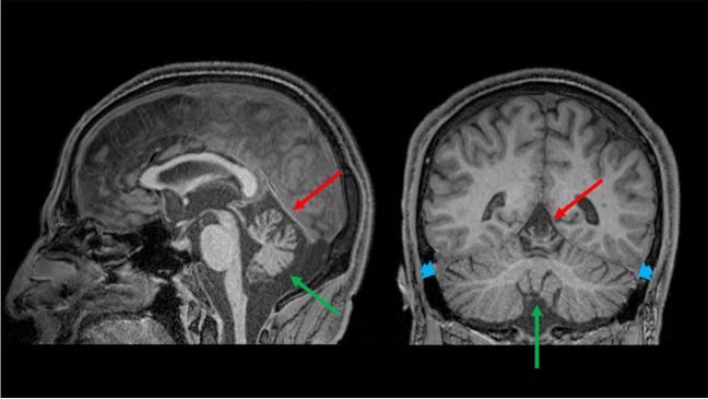 Fig. 3