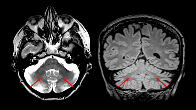 Fig. 4