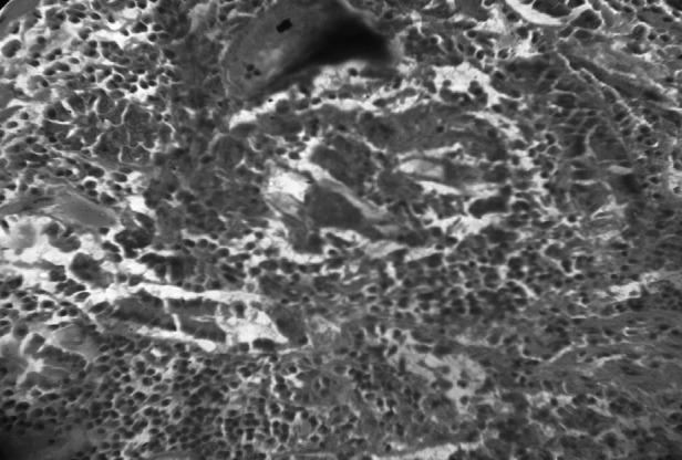 Fig. 12
