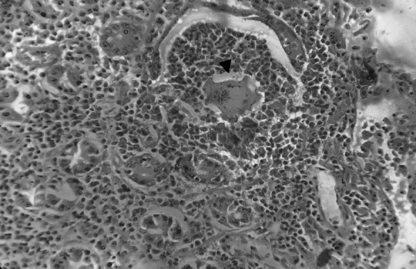 Fig. 13
