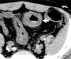 Fig. (19b).