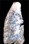 Fig. (2b).