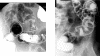 Fig. (16.b, c).