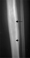 Fig. (10a).
