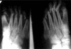 Fig. (13a).