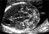 Fig. (22b).