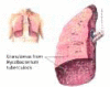Fig. (1b).