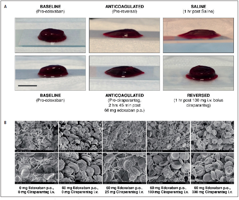 Figure 4: Visual examination of blood clots from WBCT assay pre-and post- ciraparantag versus saline