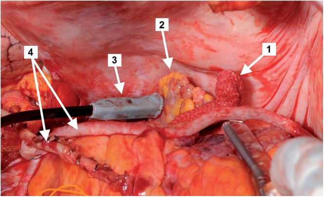 Figure 1: