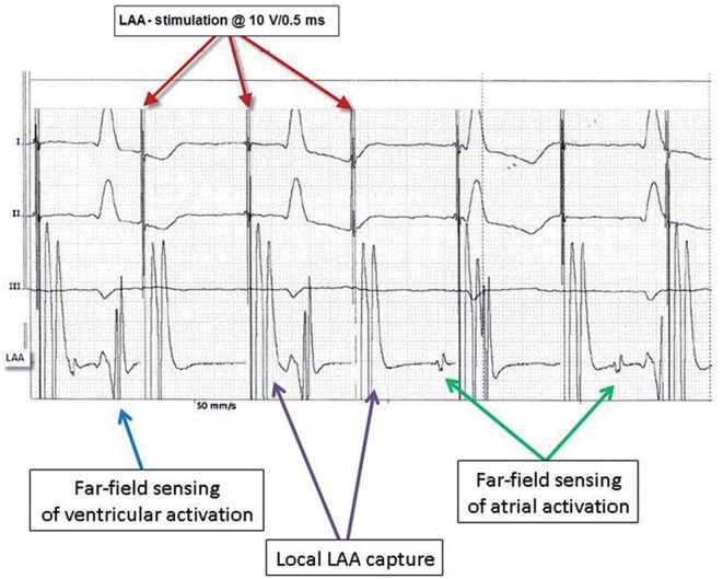 Figure 4: