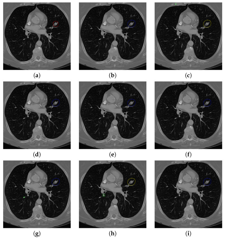 Figure 19