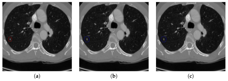 Figure 17