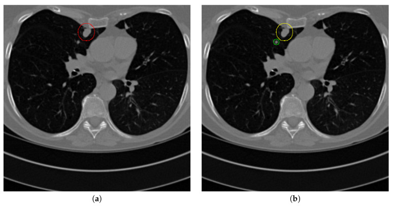 Figure 23