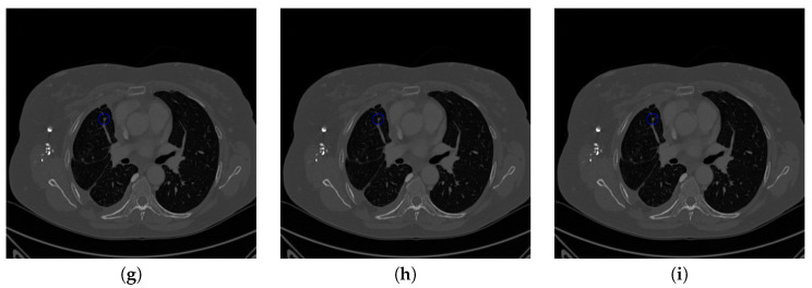 Figure 18