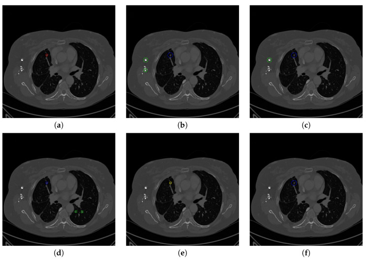 Figure 18