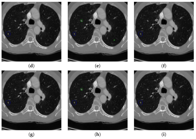 Figure 17