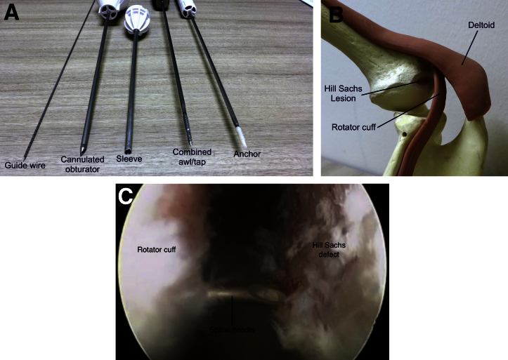 Fig 1