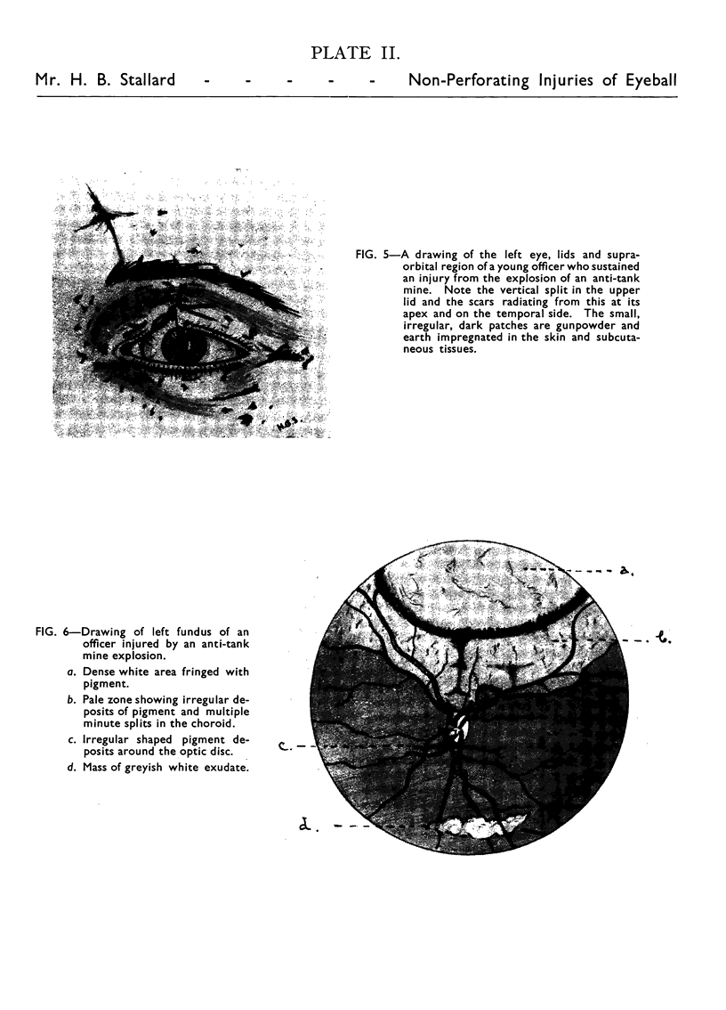 186-2