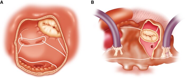 Figure 14