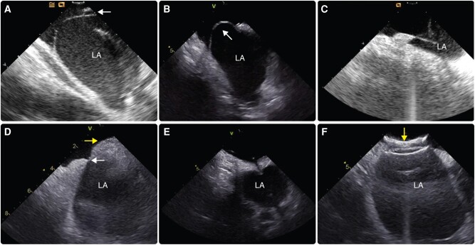 Figure 4