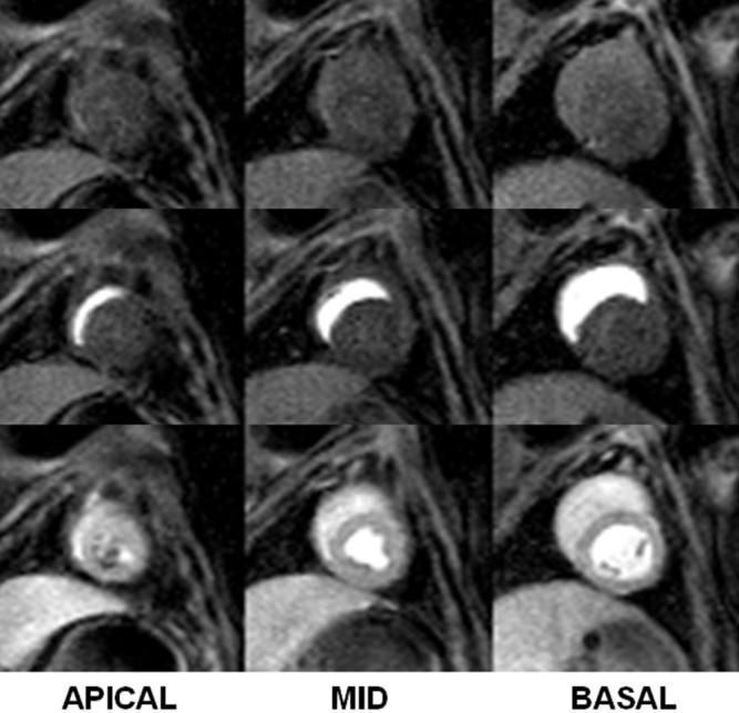 FIG. 6