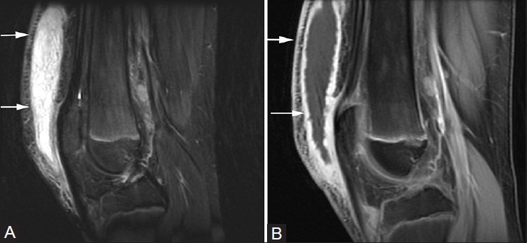 Figure 5(A, B)