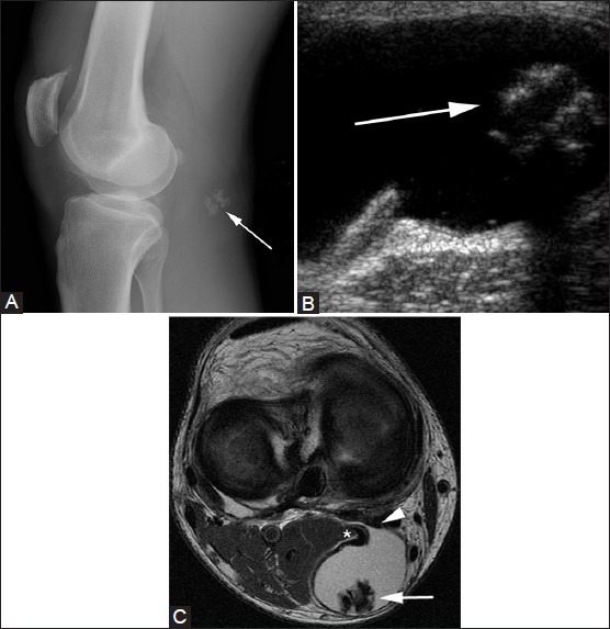 Figure 1(A-C)