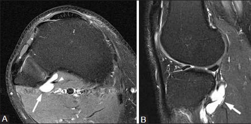 Figure 11(A, B)