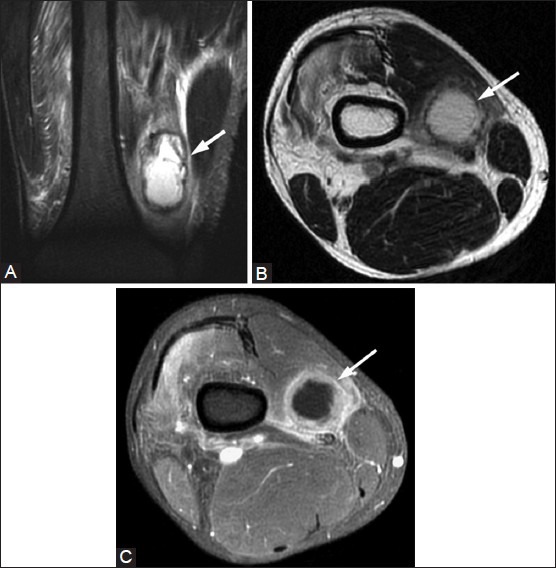 Figure 22(A-C)