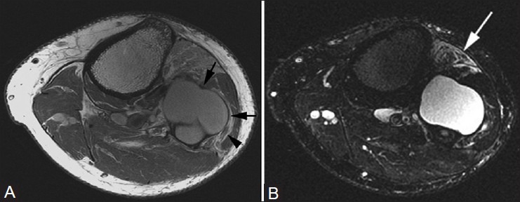 Figure 3(A, B)