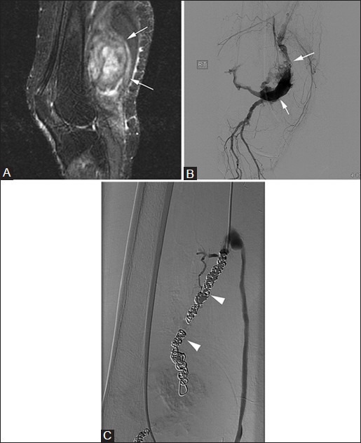 Figure 18(A-C)